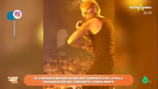 Las impactantes imágenes del cantante Reykon tras ser abrasado por las llamas Las impactantes imágenes del cantante Reykon tras ser abrasado por las llamas