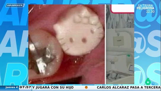 Se vuelve viral al pedirle a su odontóloga que le coloque un diente de 'Hello Kitty': "¿Esto podrías hacerlo?" Se vuelve viral al pedirle a su odontóloga que le coloque un diente de 'Hello Kitty': "¿Esto podrías hacerlo?"