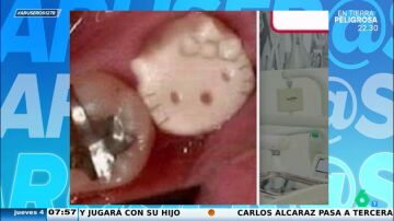 Se vuelve viral al pedirle a su odontóloga que le coloque un diente de 'Hello Kitty': "¿Esto podrías hacerlo?" 