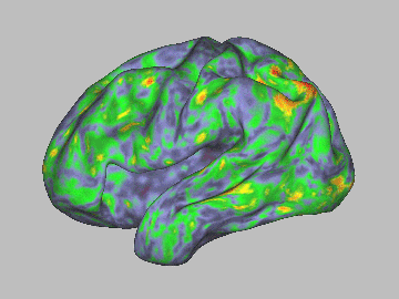 mapa del cerebro con la toma de psilocibina mapa del cerebro con la toma de psilocibina