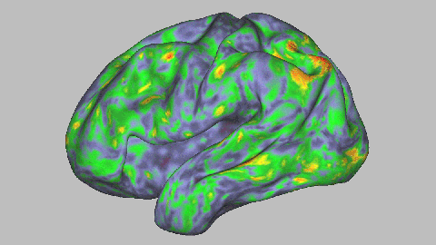 mapa del cerebro con la toma de psilocibina mapa del cerebro con la toma de psilocibina
