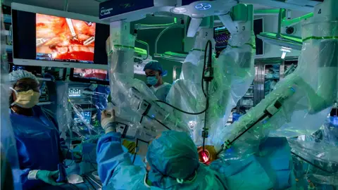 Robot encargado de llevar a cabo el primer trasplante pulmonar doble Robot encargado de llevar a cabo el primer trasplante pulmonar doble