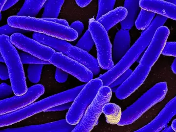 Escherichia coli Escherichia coli