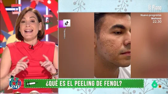 Boticaria García expone qué pacientes son adecuados para el peeling facial de fenol: "Es un tratamiento muy agresivo" Como indica la farmacéutica, este tratamiento se debe llevar a cabo de manera ambulatoria y necesita anestesia. Además, su recuperación es muy compleja y puede durar hasta tres meses.