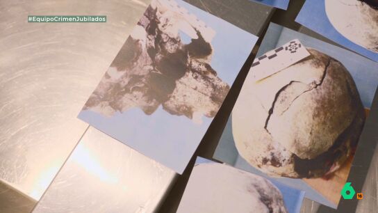 Una forense defiende la implicaci&oacute;n de varias personas en el doble crimen de Guanarteme