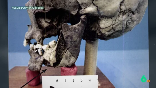 Una forense defiende la implicación de varias personas en el doble crimen de Guanarteme Una forense defiende la implicación de varias personas en el doble crimen de Guanarteme