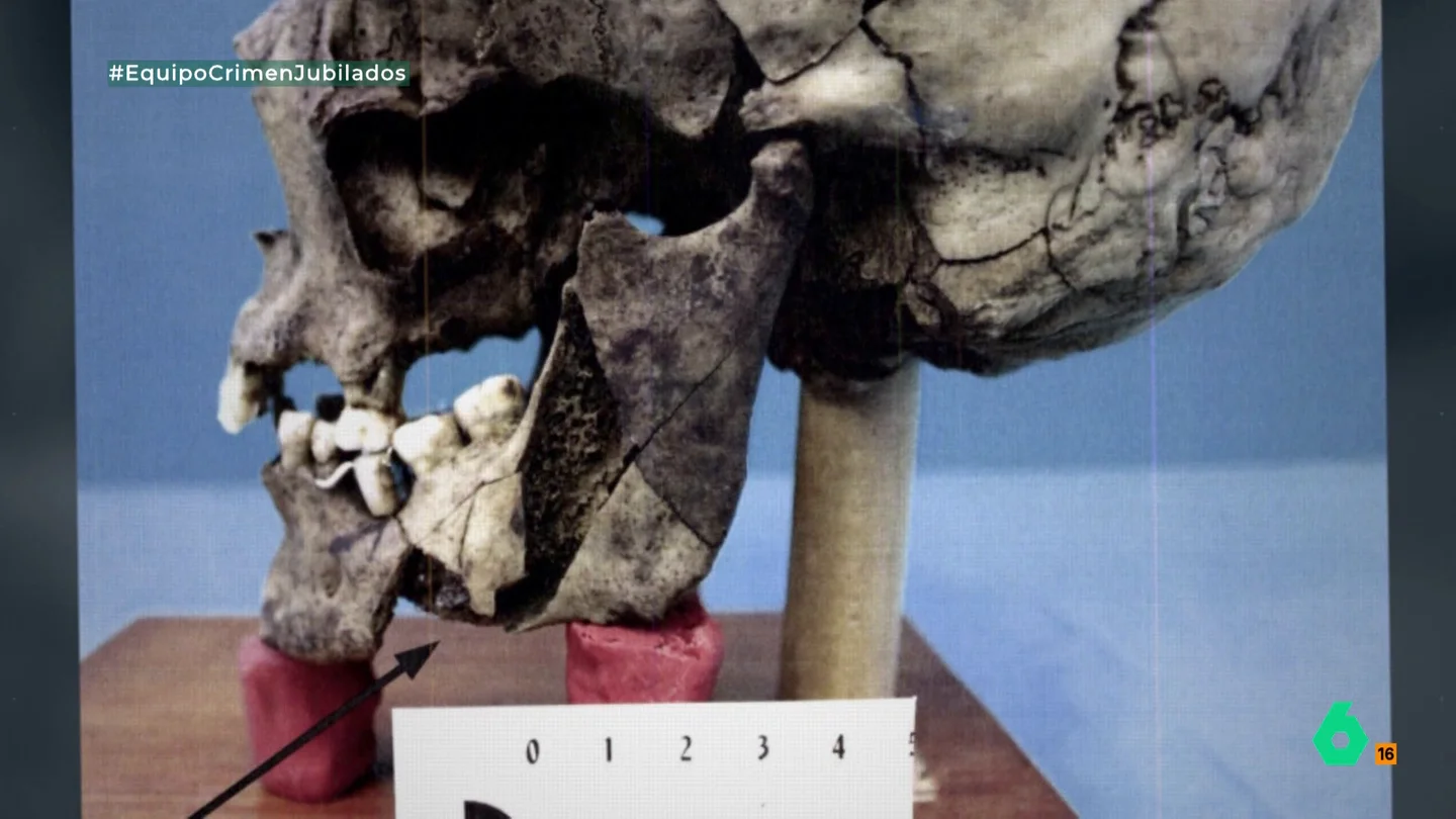 Una forense defiende la implicación de varias personas en el doble crimen de Guanarteme Una forense defiende la implicación de varias personas en el doble crimen de Guanarteme