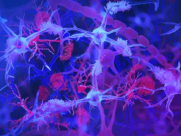 Células microglia Células microglia