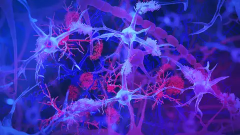 Células microglia Células microglia