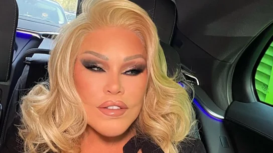 Foto de Jocelyn Wildenstein de su Instagram. Foto de Jocelyn Wildenstein de su Instagram.