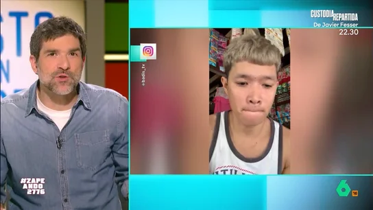 Un joven se pone pegamento en los labios y esto es lo que pasa: "No debería irse de casa de sus padres" Un joven se pone pegamento en los labios y esto es lo que pasa: "No debería irse de casa de sus padres"