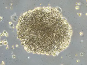 Colonia de células de cáncer de mama resistente al fármaco Rigosertib Colonia de células de cáncer de mama resistente al fármaco Rigosertib