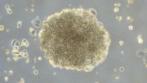 Colonia de células de cáncer de mama resistente al fármaco Rigosertib Colonia de células de cáncer de mama resistente al fármaco Rigosertib