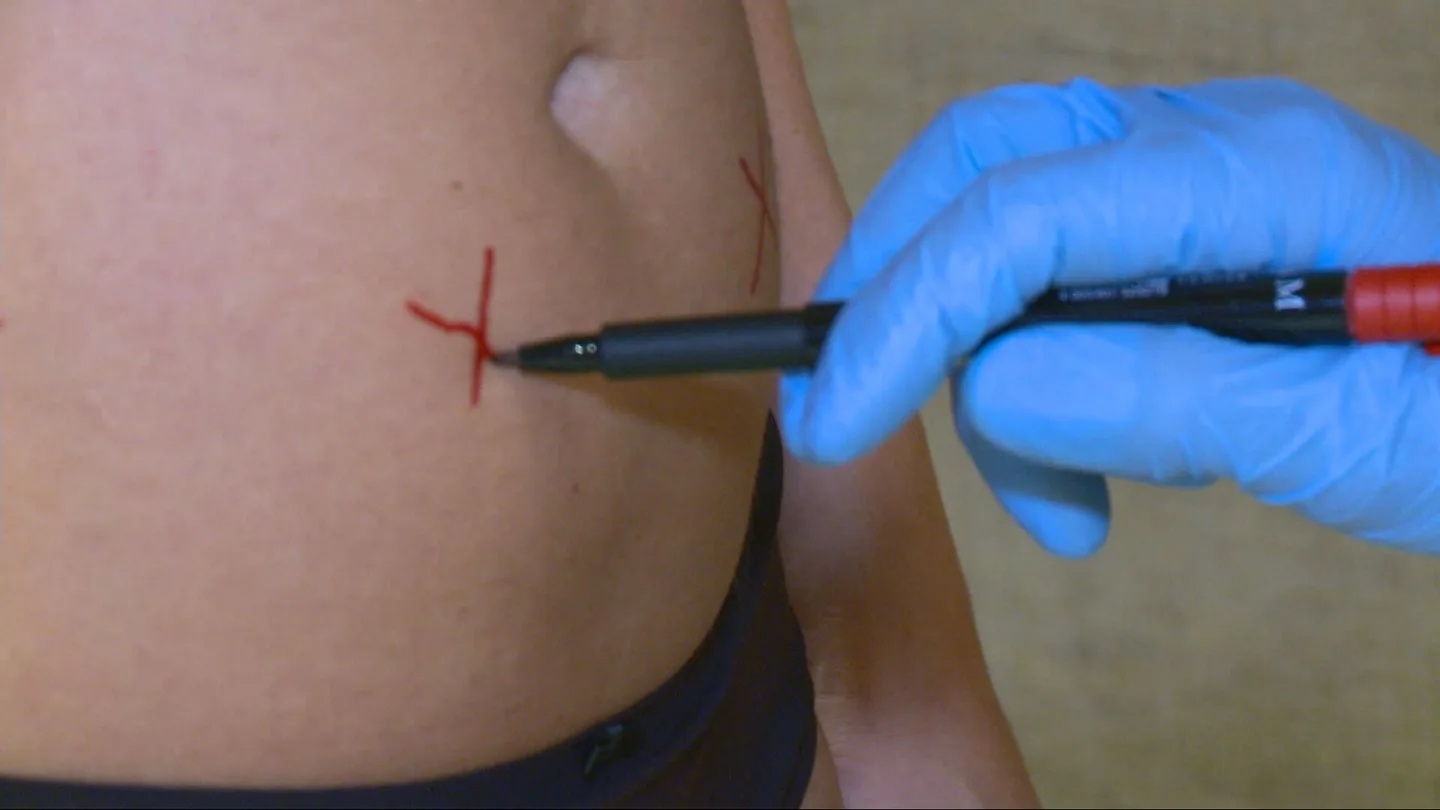 Preparación para una intervención estética Preparación para una intervención estética