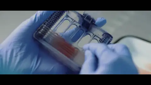 La muestra de sangre de un hombre desconocido que podría esclarecer qué pasó con Antonio Anglés 32 años después de la fuga de Antonio Anglés, laSexta.com recupera este fragmento de 'Anglés, historia de una fuga', donde los investigadores dan con la muestra de sangre de un hombre ahogado en el 93 que podría ser del asesino de Alcásser.