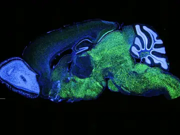 Patrón de expresión de NOVA1 en el cerebro de ratón Patrón de expresión de NOVA1 en el cerebro de ratón