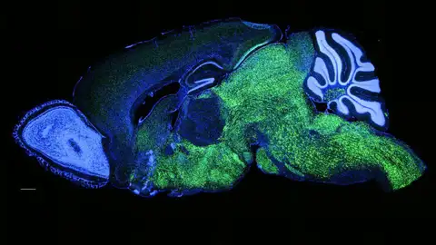 Patrón de expresión de NOVA1 en el cerebro de ratón Patrón de expresión de NOVA1 en el cerebro de ratón