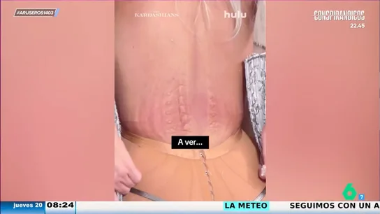 Kim Kardashian desvela las marcas que le dejó su corsé en la gala Met: "Nunca había sentido tanto dolor" Kim Kardashian desvela las marcas que le dejó su corsé en la gala Met: "Nunca había sentido tanto dolor"