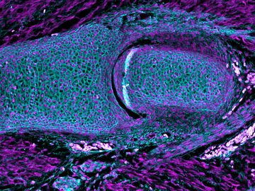 La inmunotinción de la pelvis del pequeño embrión de raya La inmunotinción de la pelvis del pequeño embrión de raya