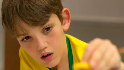 dendritas de las neuronas, síndrome de X frágil dendritas de las neuronas, síndrome de X frágil