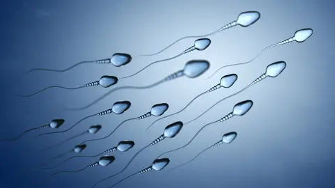 Espermatozoides Espermatozoides