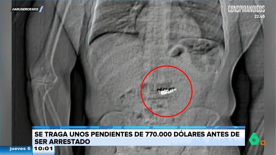 Un hombre se traga un pendiente de Tiffany valorado en 770.000 dólares antes de que la policía lo arreste Un hombre se traga un pendiente de Tiffany valorado en 770.000 dólares antes de que la policía lo arreste