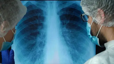 Médicos mirando una radiografía Médicos mirando una radiografía