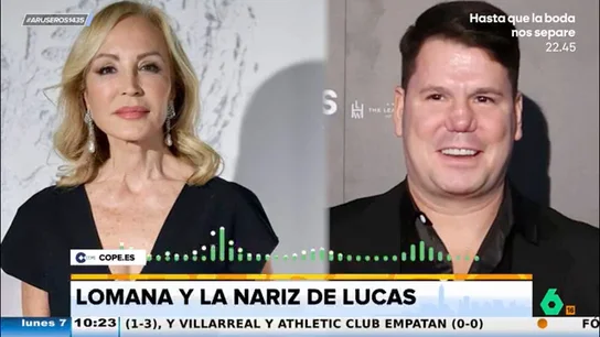 Carmen Lomana carga contra Lucas y su operación de nariz: "Lo complicado es ser sincero con el médico" Carmen Lomana carga contra Lucas y su operación de nariz: "Lo complicado es ser sincero con el médico"