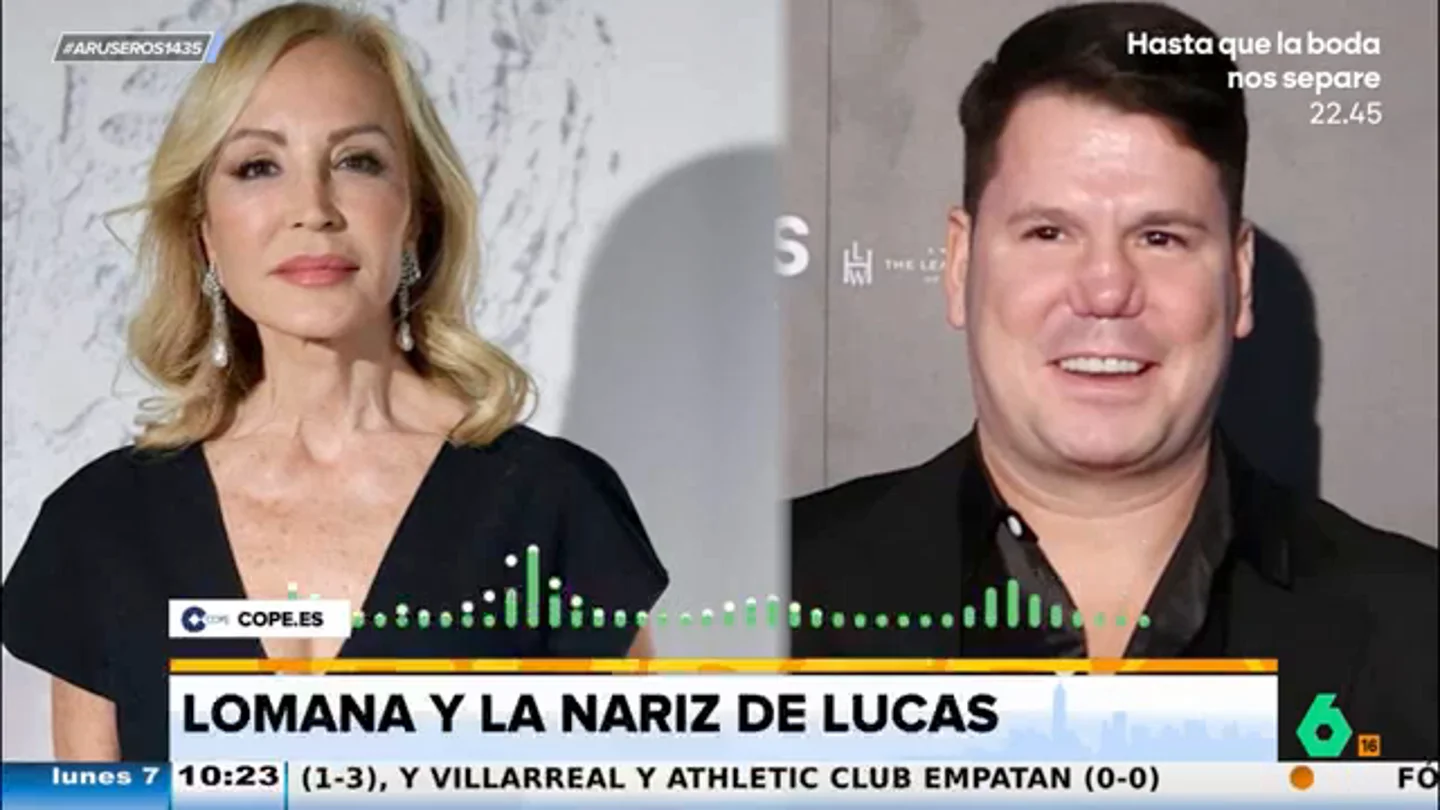 Carmen Lomana carga contra Lucas y su operación de nariz: "Lo complicado es ser sincero con el médico" Carmen Lomana carga contra Lucas y su operación de nariz: "Lo complicado es ser sincero con el médico"
