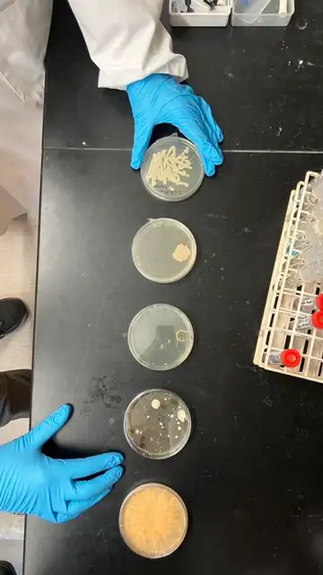 Placas de Petri que contienen colonias de los hongos patógenos Ustilago maydis y Cryptococcus neoformans, colonias de hongos aleatorias de muestras de aire y el hongo naranja Neurospora crassa Placas de Petri que contienen colonias de los hongos patógenos Ustilago maydis y Cryptococcus neoformans, colonias de hongos aleatorias de muestras de aire y el hongo naranja Neurospora crassa