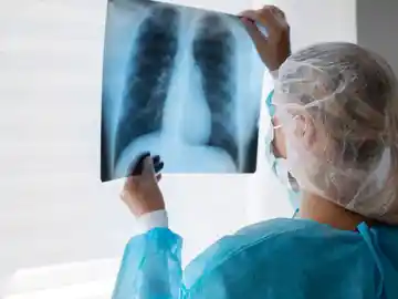 Doctora analiza una radiografía de los pulmones Doctora analiza una radiografía de los pulmones