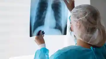 Doctora analiza una radiografía de los pulmones Doctora analiza una radiografía de los pulmones