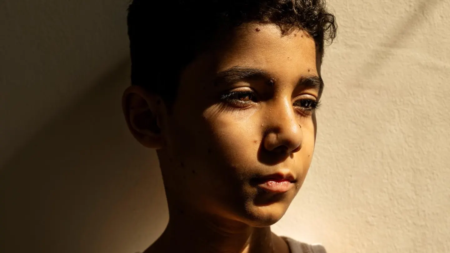 Mahmoud Ajjour, niño gazatí de 9 años a causa de un ataque de Israel en la Franja Mahmoud Ajjour, niño gazatí de 9 años a causa de un ataque de Israel en la Franja