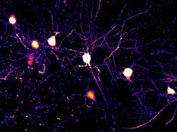 Neuronas y dendritas en la corteza cerebral de un ratón. / Komiyama Lab, UC San Diego Neuronas y dendritas en la corteza cerebral de un ratón. / Komiyama Lab, UC San Diego
