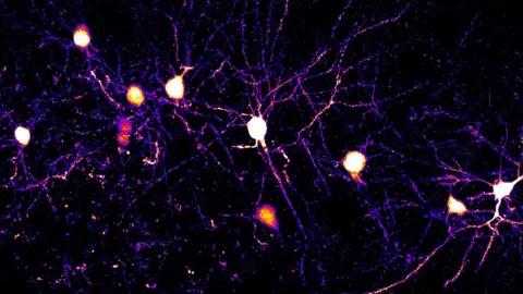 Neuronas y dendritas en la corteza cerebral de un ratón. / Komiyama Lab, UC San Diego Neuronas y dendritas en la corteza cerebral de un ratón. / Komiyama Lab, UC San Diego