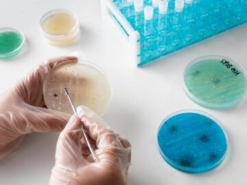 Aumento del c&aacute;ncer colorrectal en j&oacute;venes 