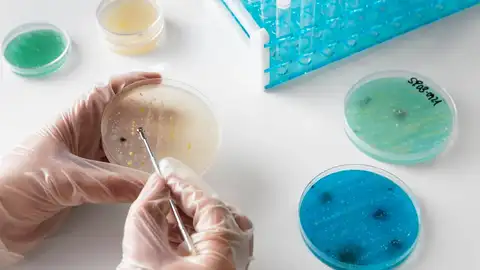 El aumento del cáncer colorrectal en jóvenes podría deberse a una infección en la infancia El aumento del cáncer colorrectal en jóvenes podría deberse a una infección en la infancia