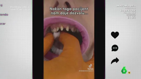 La 'sonrisa de Hollywood', la moda de sustituir todos los dientes por coronas. La 'sonrisa de Hollywood', la moda de sustituir todos los dientes por coronas.