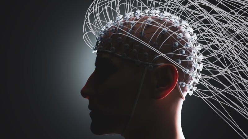 Este trastorno cerebral es más común de lo que pensamos pero a menudo no se diagnostica
