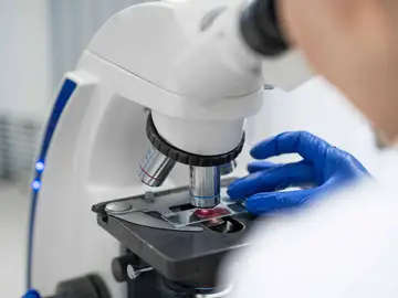 La falta de una proteína inicia el cáncer de colon en ratones La falta de una proteína inicia el cáncer de colon en ratones