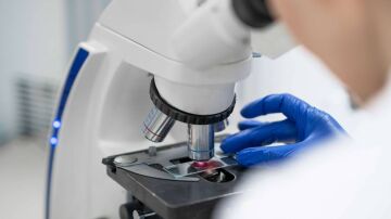 La falta de una proteína inicia el cáncer de colon en ratones