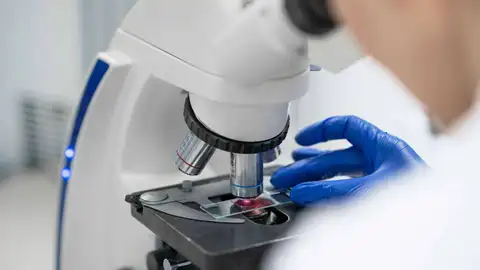 La falta de una proteína inicia el cáncer de colon en ratones La falta de una proteína inicia el cáncer de colon en ratones