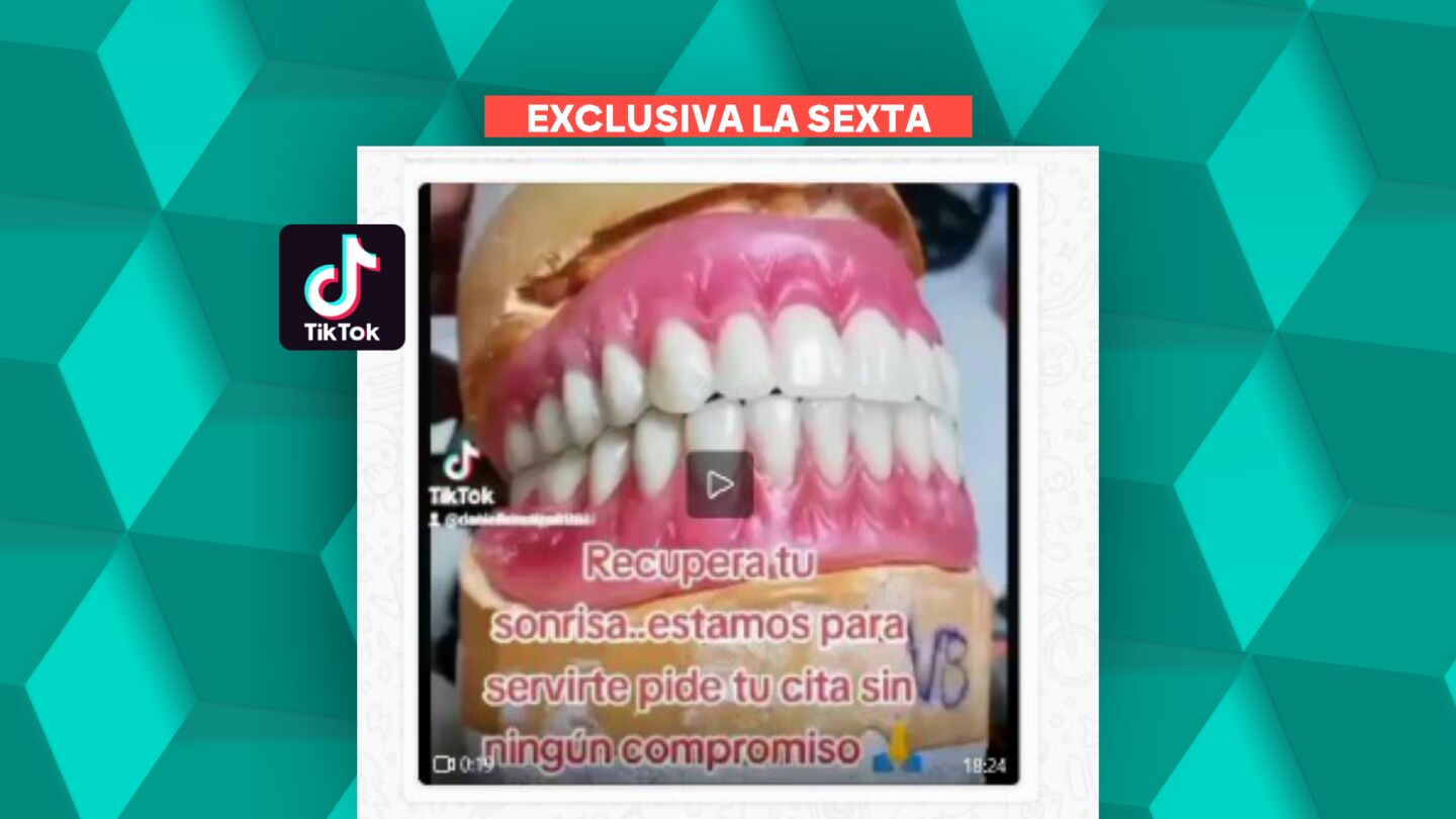 Detenido un dentista clandestino en Madrid que atendía sin licencia y rehusaba los materiales