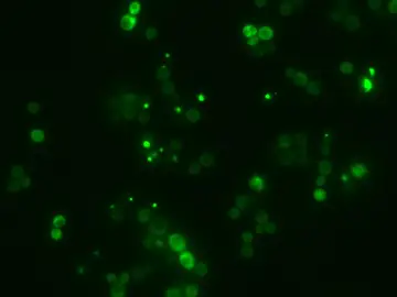 Una IA española descifra el lenguaje secreto de la agregación de proteínas Una IA española descifra el lenguaje secreto de la agregación de proteínas