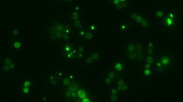 Una IA española descifra el lenguaje secreto de la agregación de proteínas