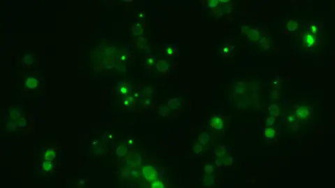 Una IA española descifra el lenguaje secreto de la agregación de proteínas Una IA española descifra el lenguaje secreto de la agregación de proteínas