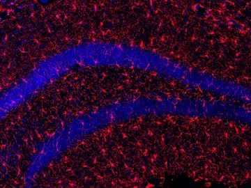 Imagen del hipocampo de los ratones tratados con s-KL Imagen del hipocampo de los ratones tratados con s-KL