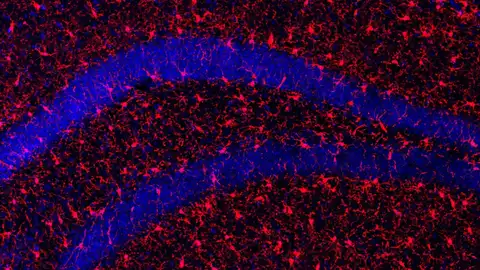 Imagen del hipocampo de los ratones tratados con s-KL Imagen del hipocampo de los ratones tratados con s-KL