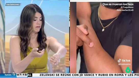 El lunar en el antebrazo que todos los millennials tienen: "Ayer lo estuvimos comprobando y sí" El lunar en el antebrazo que todos los millennials tienen: "Ayer lo estuvimos comprobando y sí"
