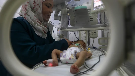 Un bebé palestino recibe tratamiento en un hospital de la Franja de Gaza. Un bebé palestino recibe tratamiento en un hospital de la Franja de Gaza.